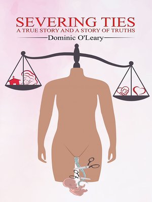 cover image of Severing Ties-A True Story and a Story of Truths